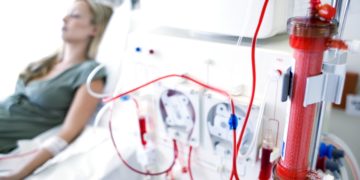 Woman getting kidney dialysis